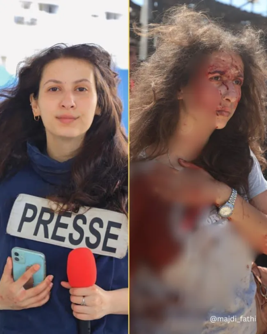 Well known Gazan journalist with fake injuries